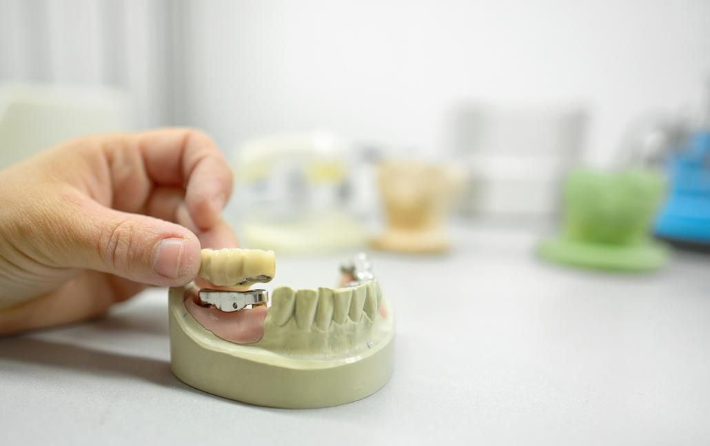 Image showing Dental veneers placement Aldie