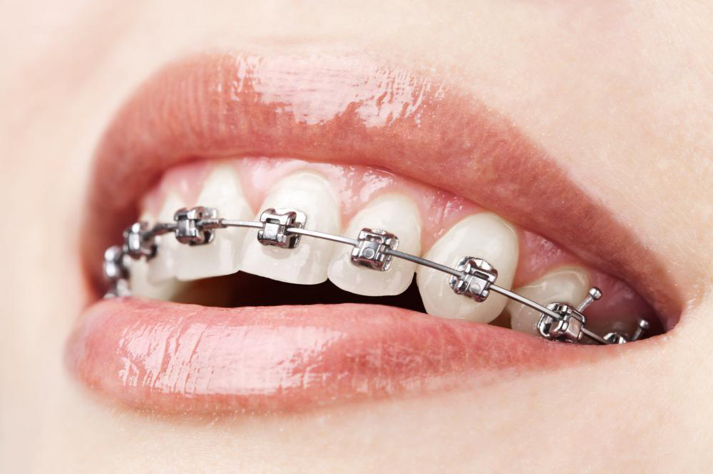 Things You Need to Know About Cosmetic Dentistry Procedures and Treatments